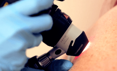 A planáris szemölcs diagnosztikai módszerei