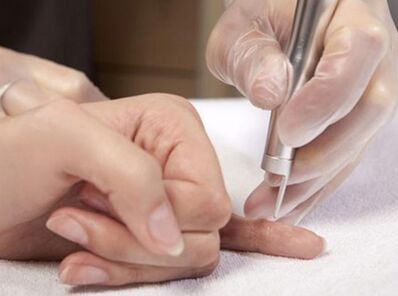 Lézerterápia lefolytatása