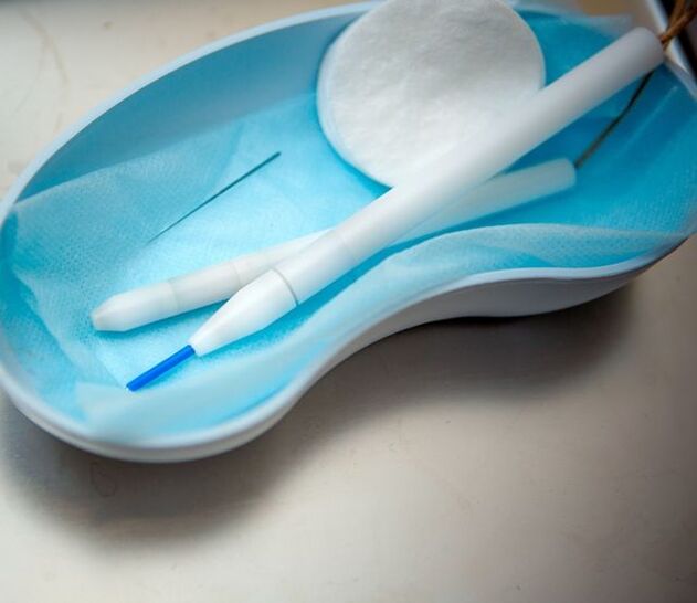 Eltávolítási módszerek