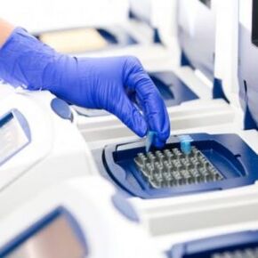 PCR elemzés