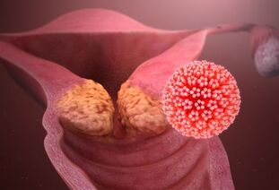 milyen betegségek okozzák a HPV-t